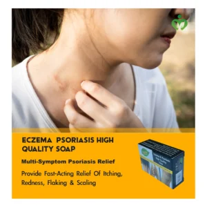 Eczema and Psoriasis High-Quality Soap