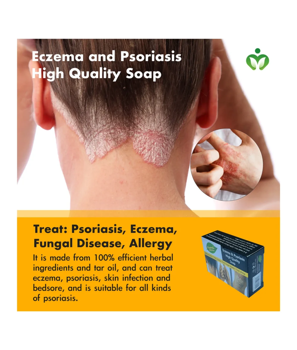 Eczema and Psoriasis High-Quality Soap