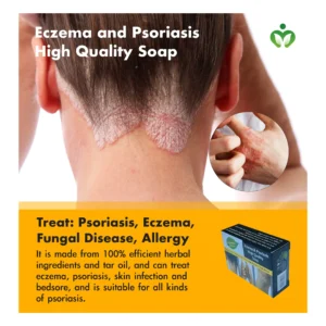 Eczema and Psoriasis High-Quality Soap