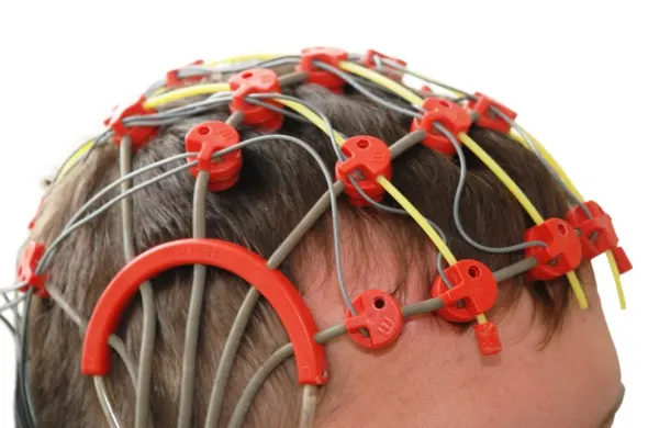 Epilepsy Explained: Understanding Seizures, Treatment & Support for Better Living Epilepsy Explained: Understanding Seizures, Treatment & Support for Better Living