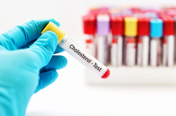 Hypercholesterolemia Explained: How to Manage Cholesterol for a Healthy Heart Hypercholesterolemia Explained: How to Manage Cholesterol for a Healthy Heart