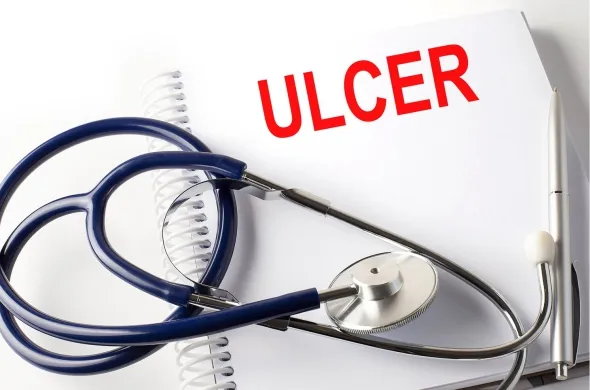 Ulcers Explained: Causes, Symptoms, Treatment and Prevention of Digestive Sores Ulcers Explained: Causes, Symptoms, Treatment and Prevention of Digestive Sores