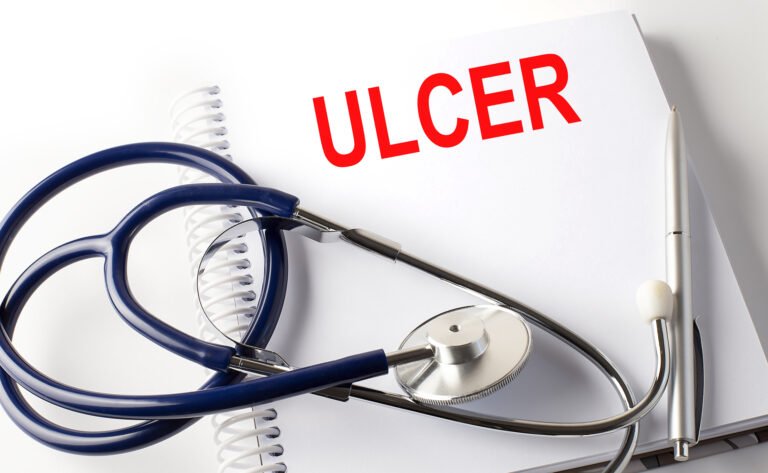 ulcers