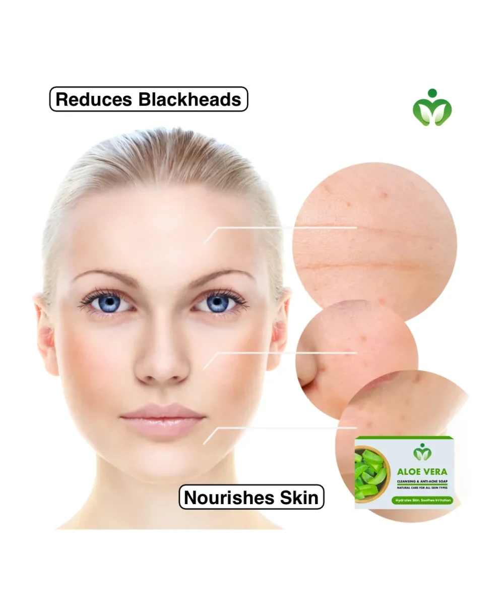 aloe vera cleansing and anti acne soap