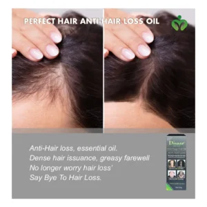 Hair Essential Oil: Anti-Hair Loss Serum