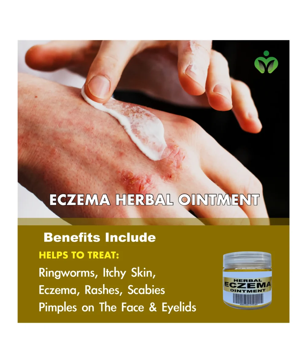 Herbal Eczema Ointment