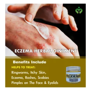 Herbal Eczema Ointment