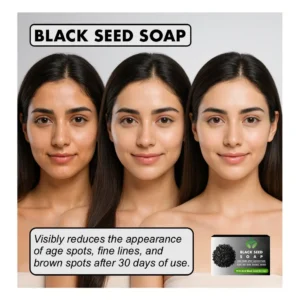 Black Seed Soap for Dark Spots, Acne, Dry Skin & Even-Tone Results